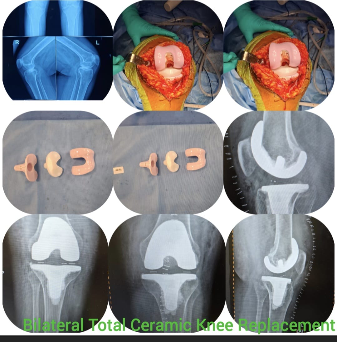 Knee X-ray 5